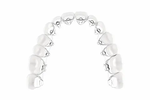 見えにくい舌側矯正とは